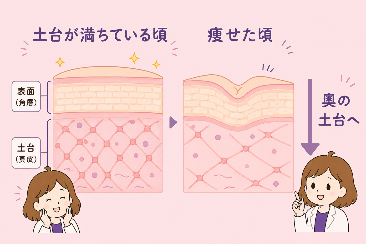 表面と奥の土台(真皮)の対比を示す肌断面の図解