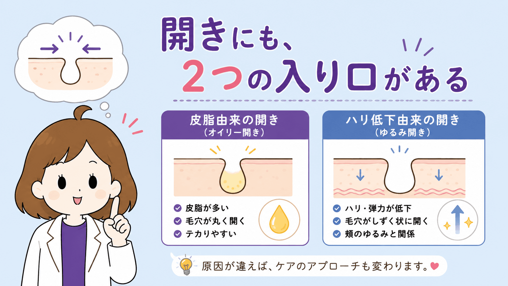 詰まって開くタイプとゆるんで開くタイプの分岐図解