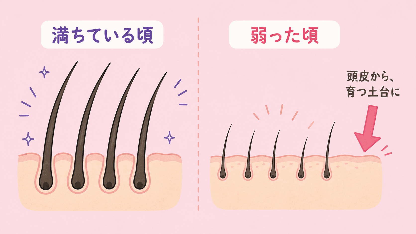 髪を太く長く育てる力が揺らぐ様子の図解